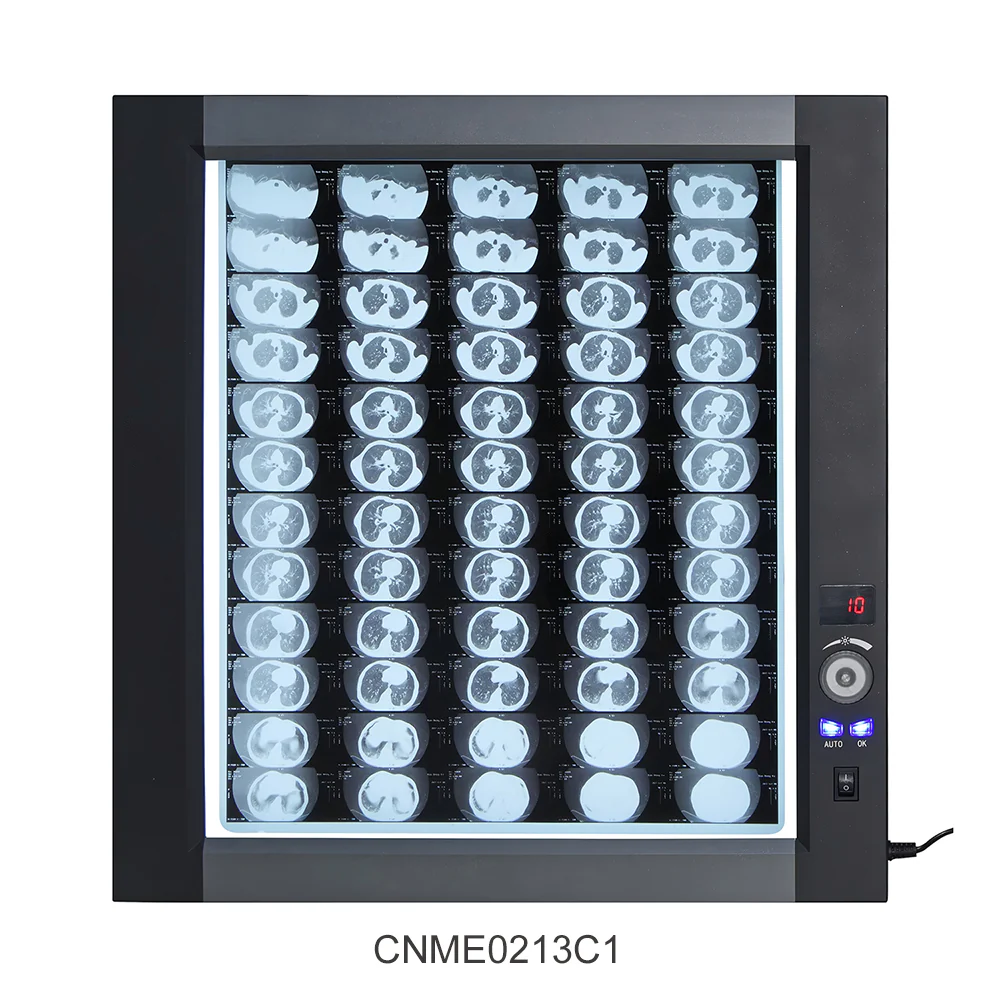 Visionneuse de film médical à LED
