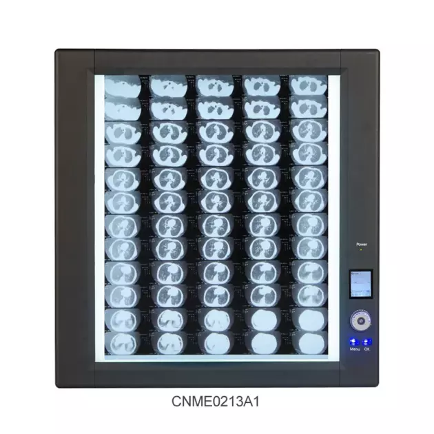 Visionneuse de films radiographiques à rétroéclairage LED ultra-lumineux