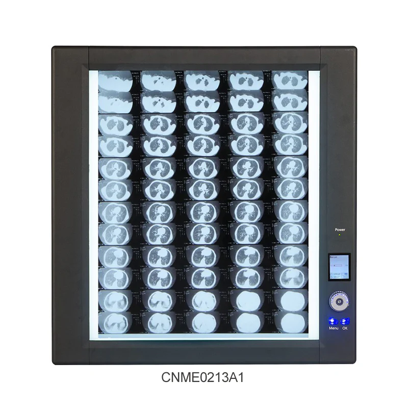 Visionneuse de films radiographiques à rétroéclairage LED ultra-lumineux