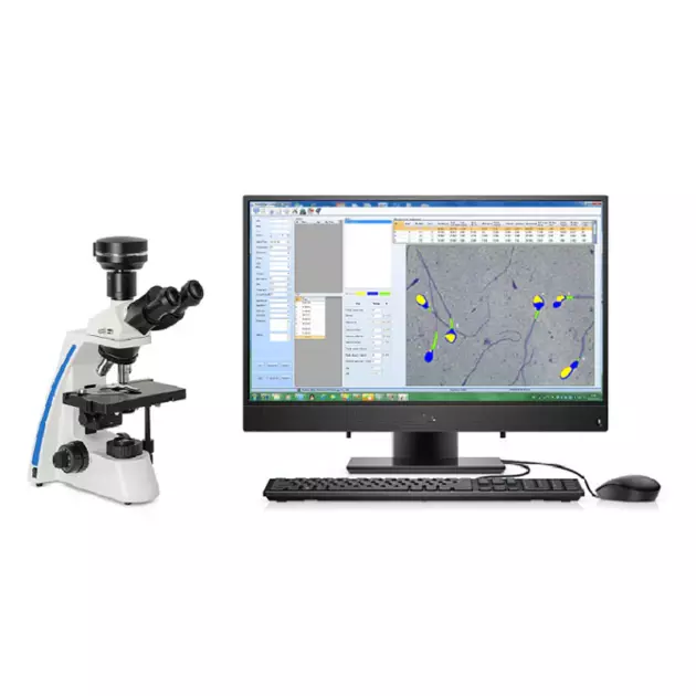 Analyseur de spermatozoïde